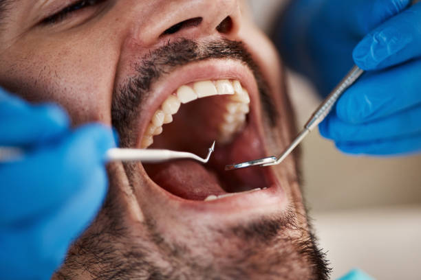 Best Chipped Tooth Repair Near Me  in Westport Village, CT